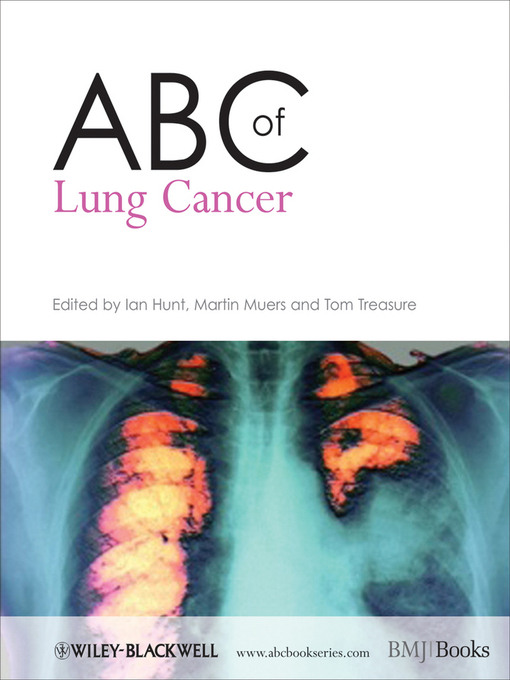 Title details for ABC of Lung Cancer by Ian Hunt - Available